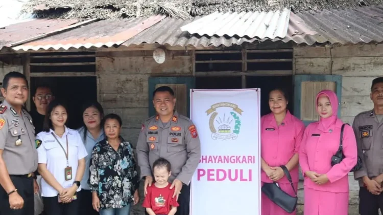Polres Nias Selatan Fasilitasi Pengobatan Anak Penderita Stunting