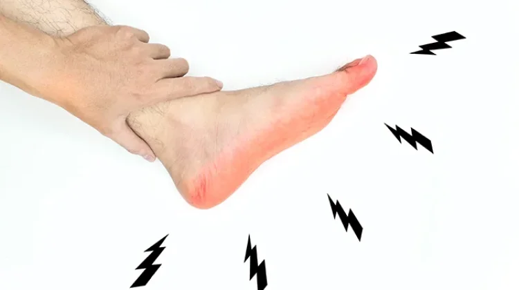Tangan dan Kaki Sering Kebas, Apa Penyebabnya?