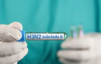 Pandeglang Belum Miliki Alat Deteksi Influenza A