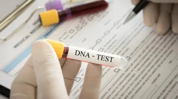Tes DNA dan Manfaatnya Bagi Perencanaan Kesehatan