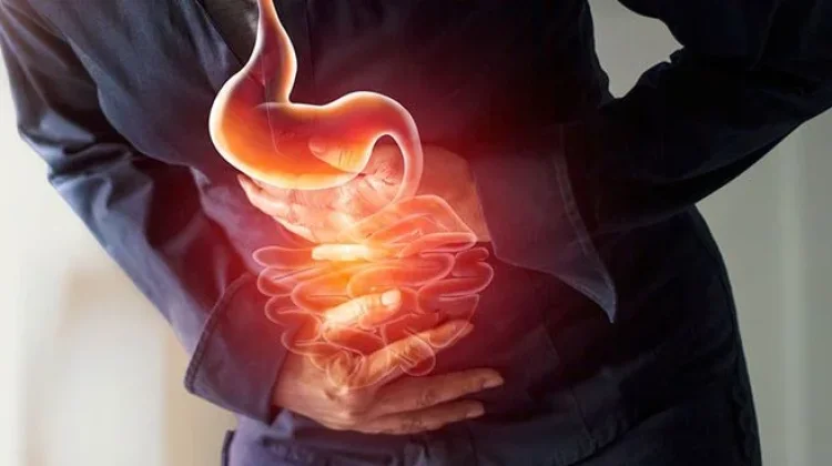 Cara Mengatasi Asam Lambung yang Tiba-tiba Naik: Solusi Cepat dan Efektif