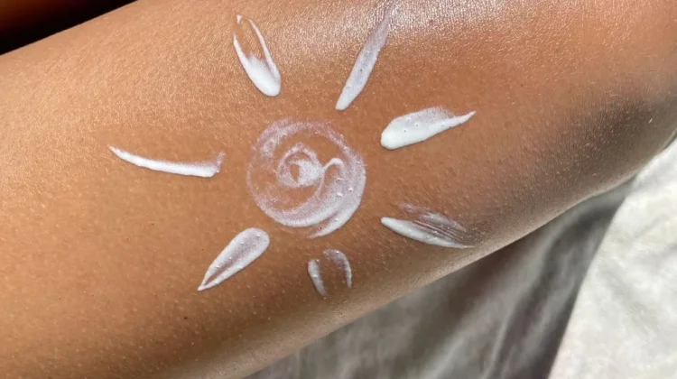 Dermatolog Tekankan Pentingnya Sunscreen untuk Melindungi Kesehatan Kulit