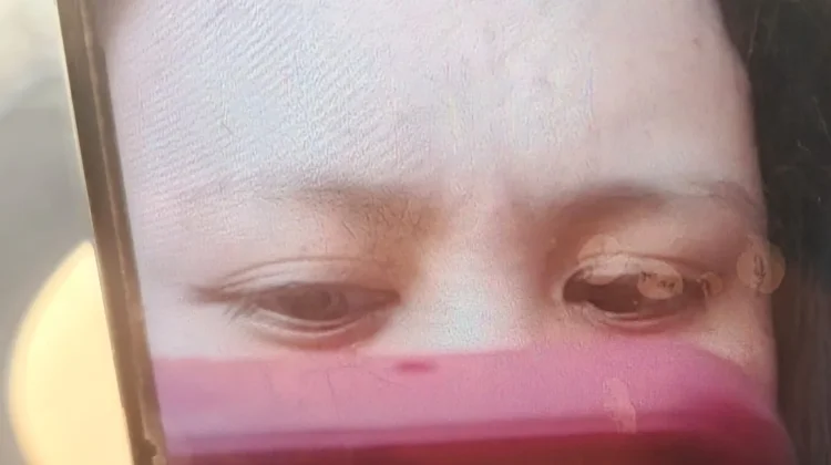 Kepribadian Orang yang Foto Hanya Menunjukkan Kening, Alis dan Mata