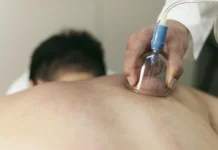 Mengenal Manfaat Bekam bagi Penderita Kolesterol dan Pegal Linu