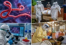 Epidemiolog Sebut Ebola Tak Semudah Covid-19 Jadi Pandemi Global