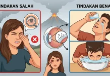 Awas Bahaya Abu Vulkanik pada Mata: Jangan Dikucek meski Terasa Gatal
