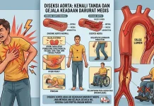 Nyeri Dada Mendadak, Waspadai Gejala Diseksi Aorta