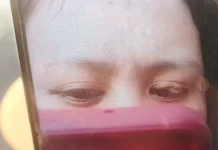 Kepribadian Orang yang Foto Hanya Menunjukkan Kening, Alis dan Mata