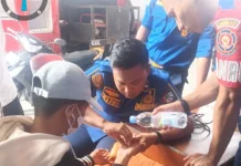 Damkarmat Touna Bantu Keluarkan Cincin Nyangkut di Jari Tangan Warga