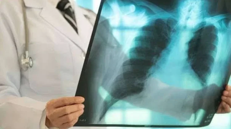 Fokus Kepatuhan Pengobatan dan Keluarga