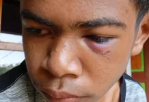 Pemuda Banain A Diduga Dikeroyok Sekelompok Pemuda Faenake