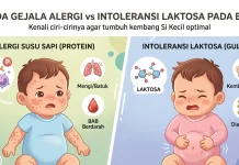 Ciri Bayi Tidak Cocok Susu Formula, Harus Segera Disadari