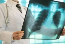 Fokus Kepatuhan Pengobatan dan Keluarga