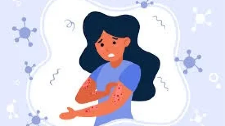 Sebelum Terlambat, Kenali Gejala Lupus sejak Awal