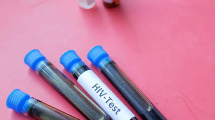 Dinkes Banda Aceh Ungkap Faktor Risiko Penularan HIV