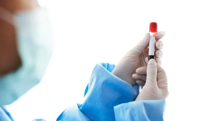 Ini Syarat HB Perempuan ketika ingin Donor Darah