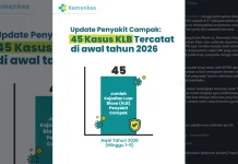 Kasus Campak Turun 93 Persen, Kemenkes Tetap Perketat Pengawasan