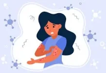 Sebelum Terlambat, Kenali Gejala Lupus sejak Awal