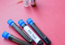 Dinkes Banda Aceh Ungkap Faktor Risiko Penularan HIV