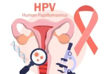 Kenali Infeksi HPV lewat Pemeriksaan HPV DNA