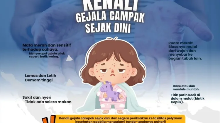 Kenali Gejala Campak sejak Dini pada Anak