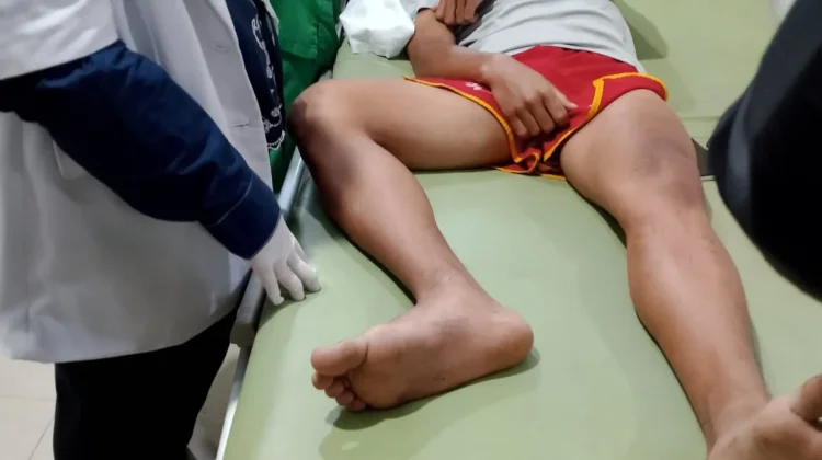 Atlet Tinju PON Lampung Dianiaya Pakai Cangkul