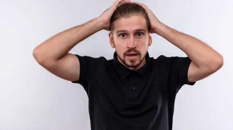 Rambut Mendadak Botak, Kenali Tanda Alopecia Areata