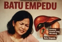 Mengenal Batu Empedu dan Cara Mengatasinya