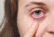 Jangan Sepelekan! Pentingnya Menghapus Makeup Area Mata Sebelum Tidur