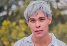 Uban Muncul di Usia Muda, Apa Penyebabnya?