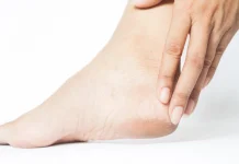 Tumit Kaki Kering dan Pecah-Pecah Bikin Tak Nyaman? Ini Cara Sederhana Mengatasinya