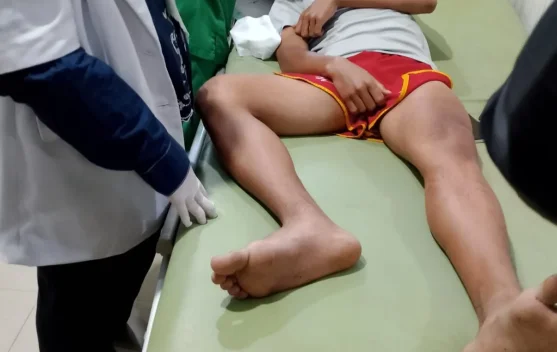 Atlet Tinju PON Lampung Dianiaya Pakai Cangkul