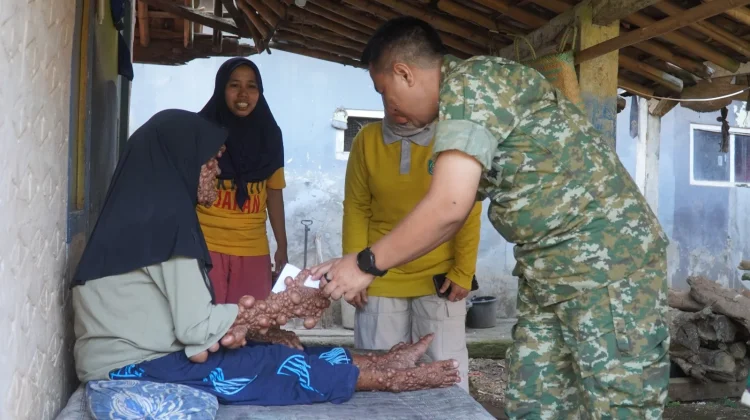Kepedulian Kodim 0605/Subang, Beri Bantuan Kepada Warga yang Sakit