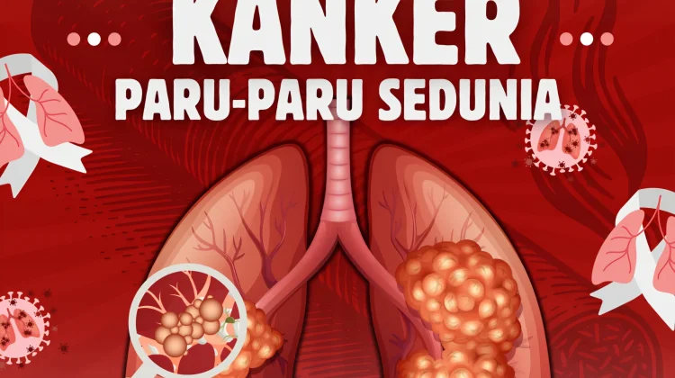 Hari Kanker Paru Sedunia, Momentum Peningkatan Kesadaran Masyarakat