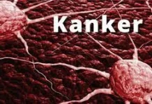 Ini Strategi Akses Terapi Kanker yang Lebih Efektif