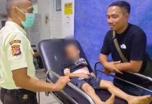 Seorang Anak di Cibeber Cianjur Terluka Diserang Monyet