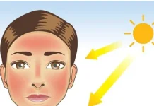 Bahaya Sinar Ultraviolet Bagi Kulit dan Cara Mengatasinya