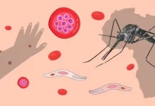 Anak jadi Kelompok Lebih Rentan Terhadap Malaria Berat