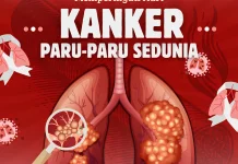 Hari Kanker Paru Sedunia, Momentum Peningkatan Kesadaran Masyarakat