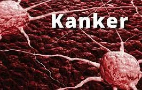 Ini Strategi Akses Terapi Kanker yang Lebih Efektif