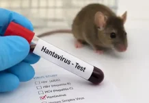 Virus Tikus Mengintai! Dinkes Ingatkan Hantavirus Serang Paru-Paru hingga Ginjal