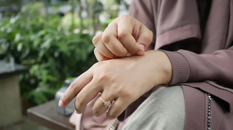Abses Kulit Jangan Dipencet Sembarangan