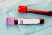 Ramadan, PMI Kabupaten Serang Pastikan Stok Darah Aman