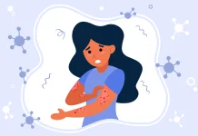 Hari Lupus Sedunia, Penyakit Seribu Wajah yang Kerap Lambat Disadari