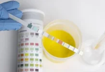 BNN Banten Dorong Tes Urine Pejabat Secara Berkala