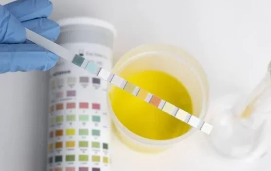 BNN Banten Dorong Tes Urine Pejabat Secara Berkala