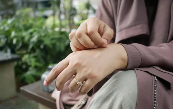 Abses Kulit Jangan Dipencet Sembarangan