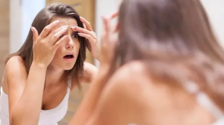 Sering Muncul Jerawat di Bibir? Kenali Penyebab dan Cara Mencegahnya