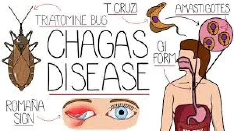 Pentingnya Peringatan Hari Penyakit Chagas Sedunia