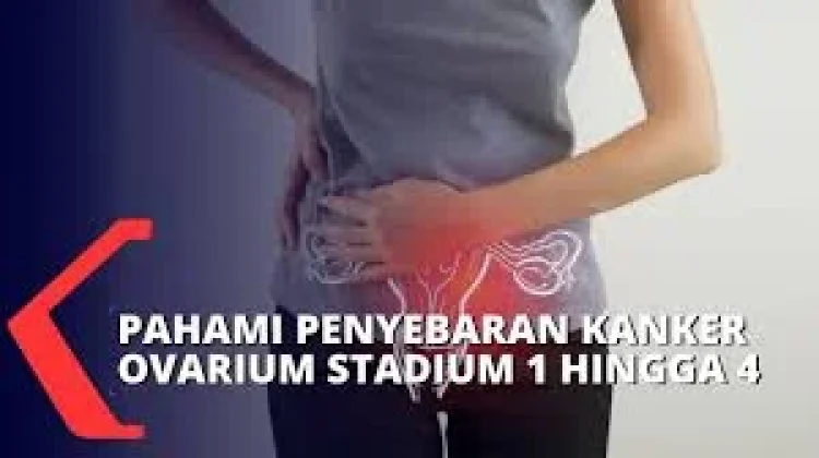 Pentingnya Hari Kanker Ovarium Sedunia untuk Wanita Dunia